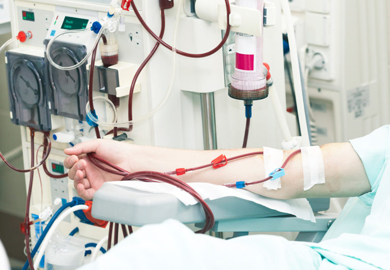 How We’re Transforming Dialysis Technical Operations - Bion